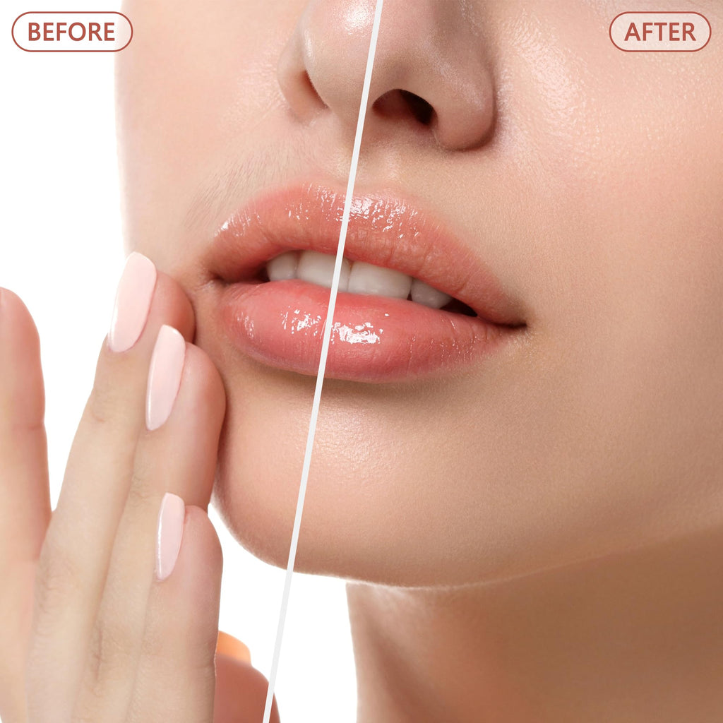 Facial Hair Remover P79426