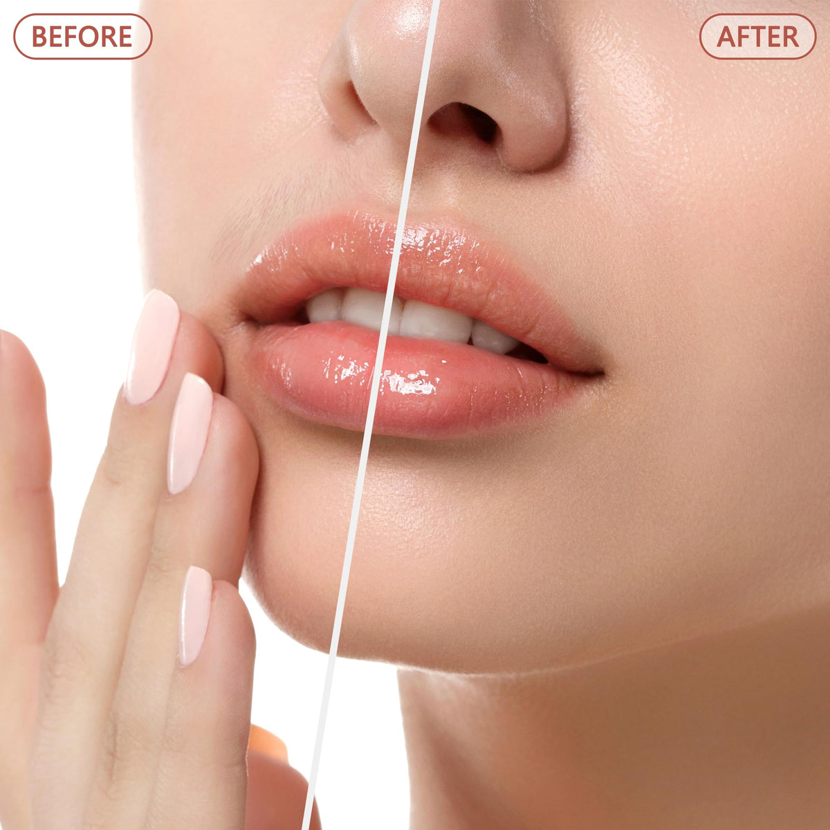 Facial Hair Remover P79426